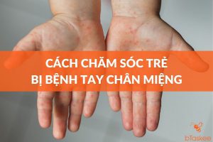 Cách chăm sóc trẻ em bị bệnh tay chân miệng