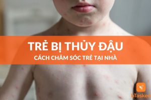 Cách chăm sóc trẻ bị thủy đậu